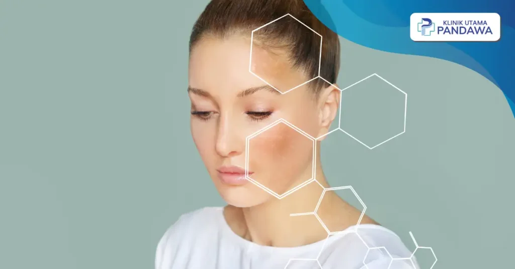 Hiperpigmentasi & Penuaan Dini