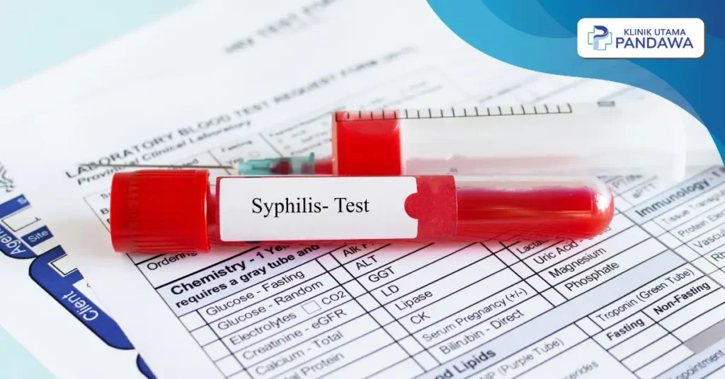 ciri-ciri sifilis akan sembuh