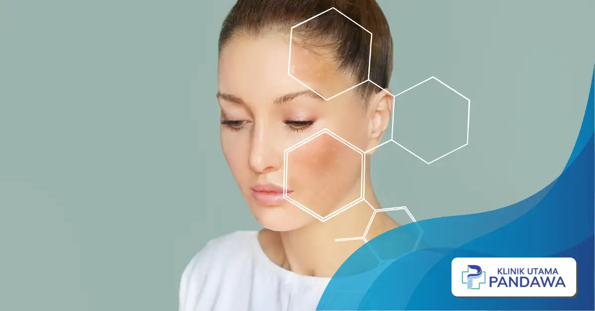 Kulit Belang Bikin Nggak Pede? Ini Cara Ampuh Biar Warnanya Merata Lagi!