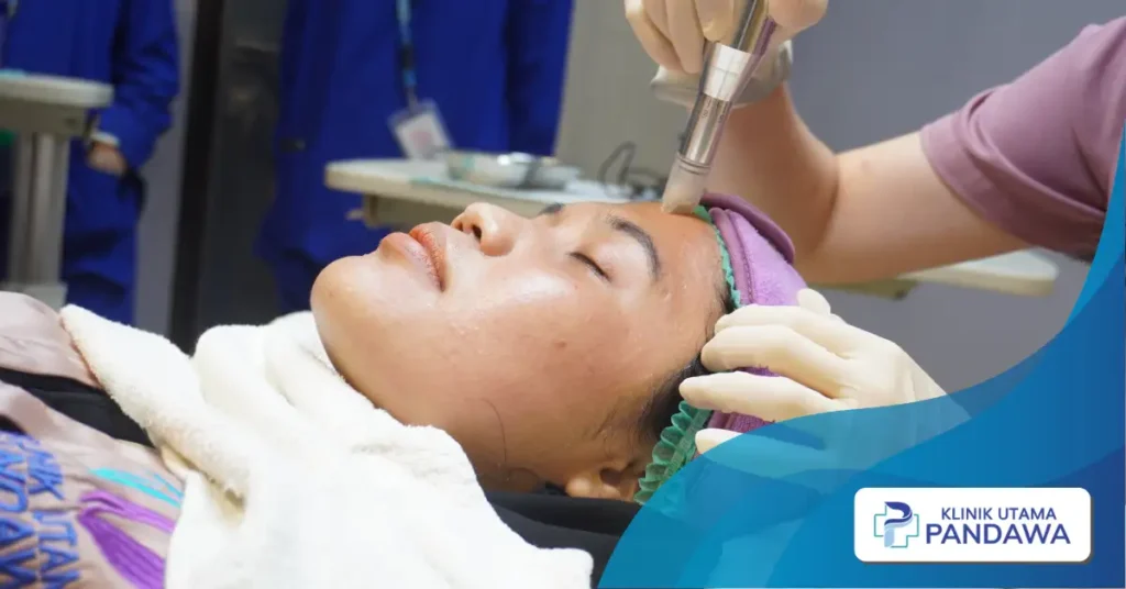 microneedling