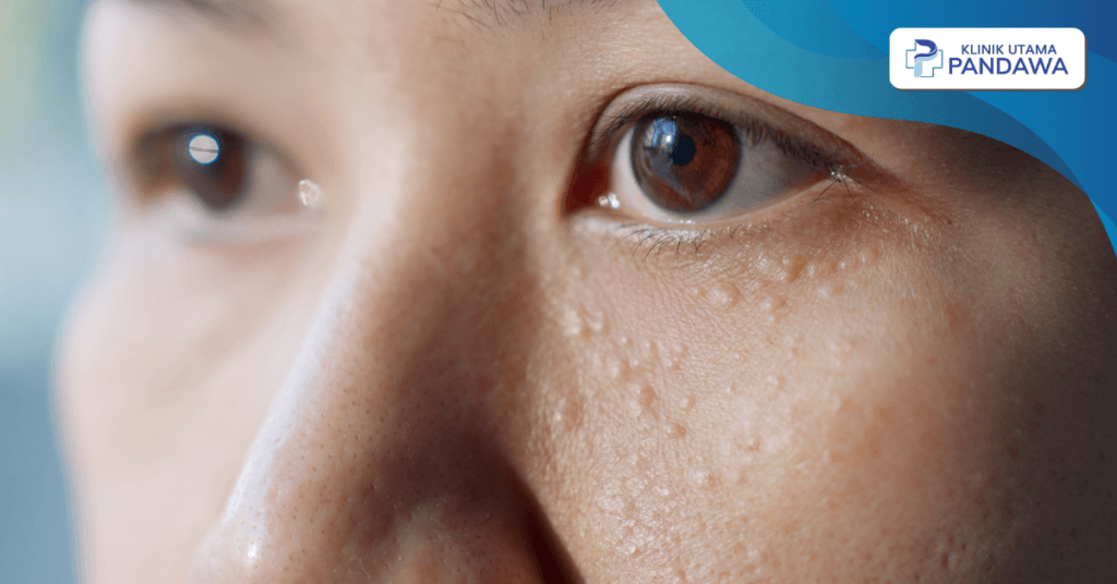 bintik putih di wajah