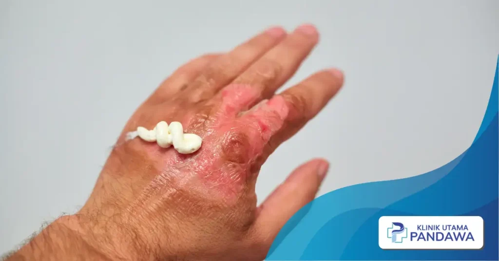 obat kena knalpot