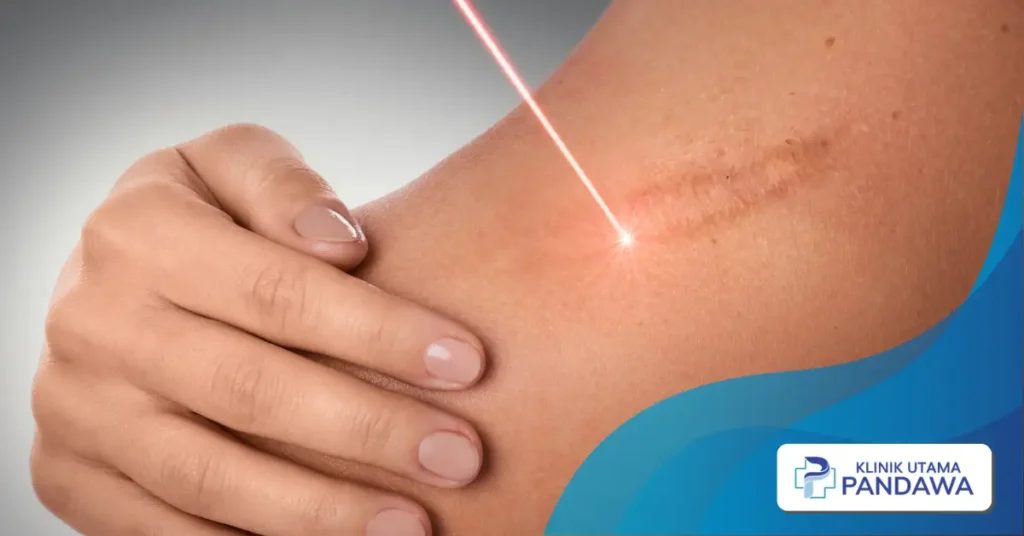 scar removal