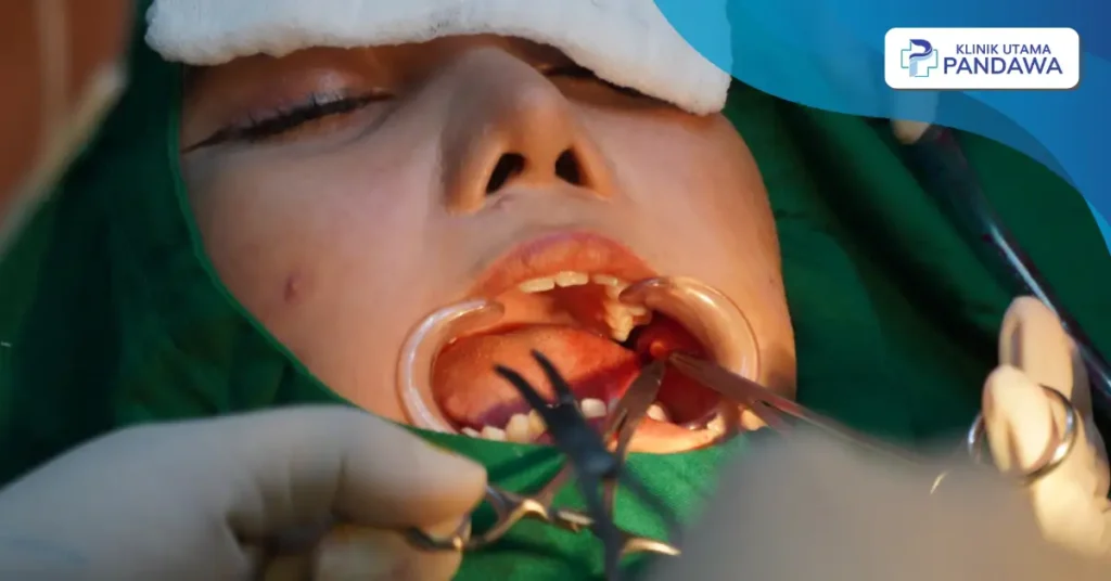 cara meniruskan pipi