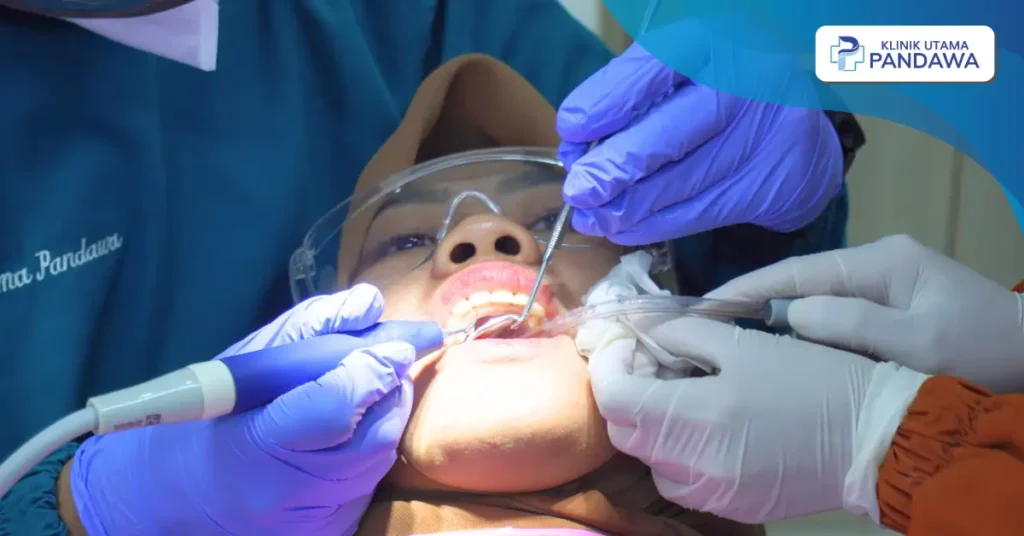 Perbedaan dental spa dan scaling