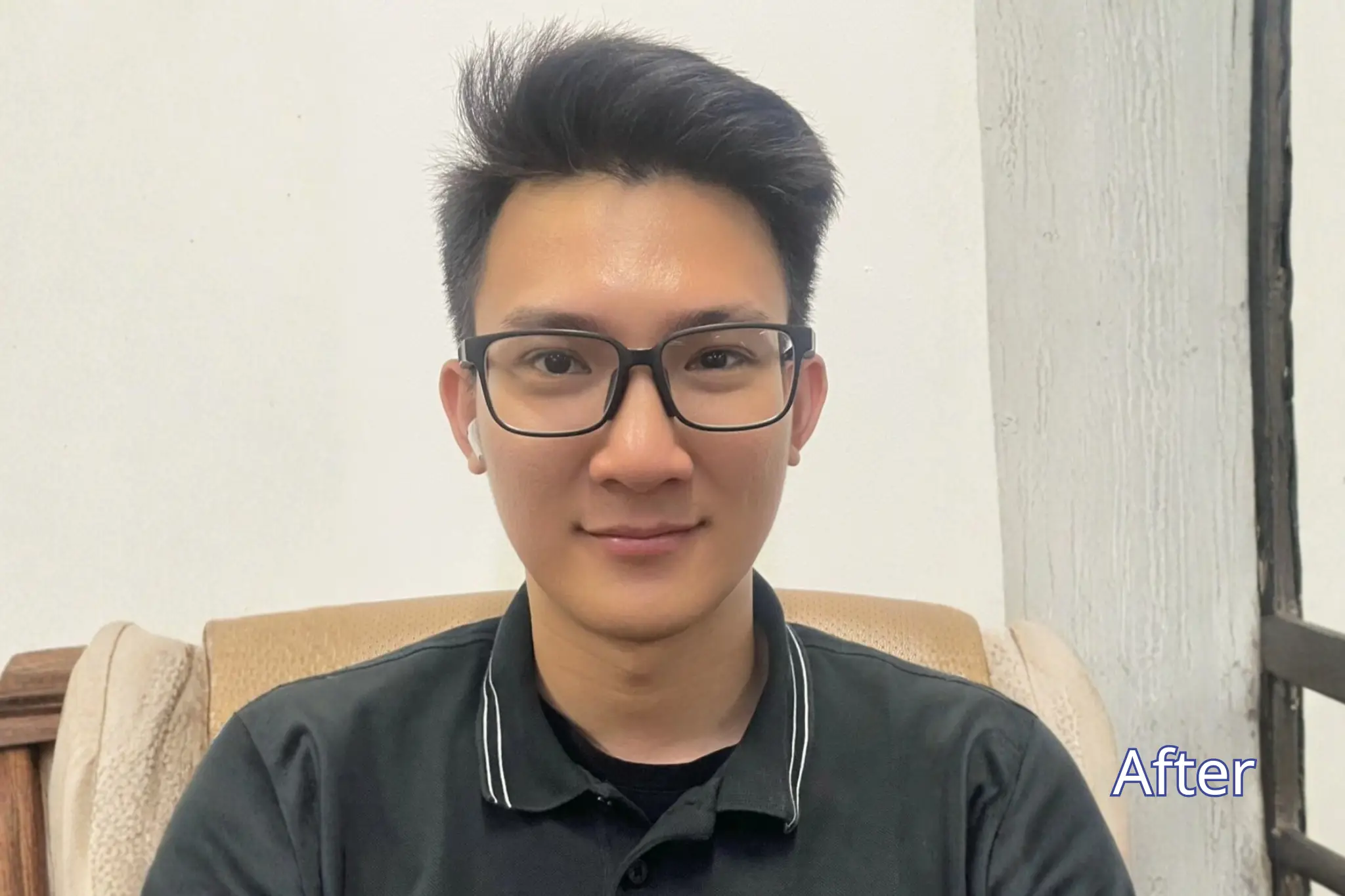 Skin booster pandawa 1