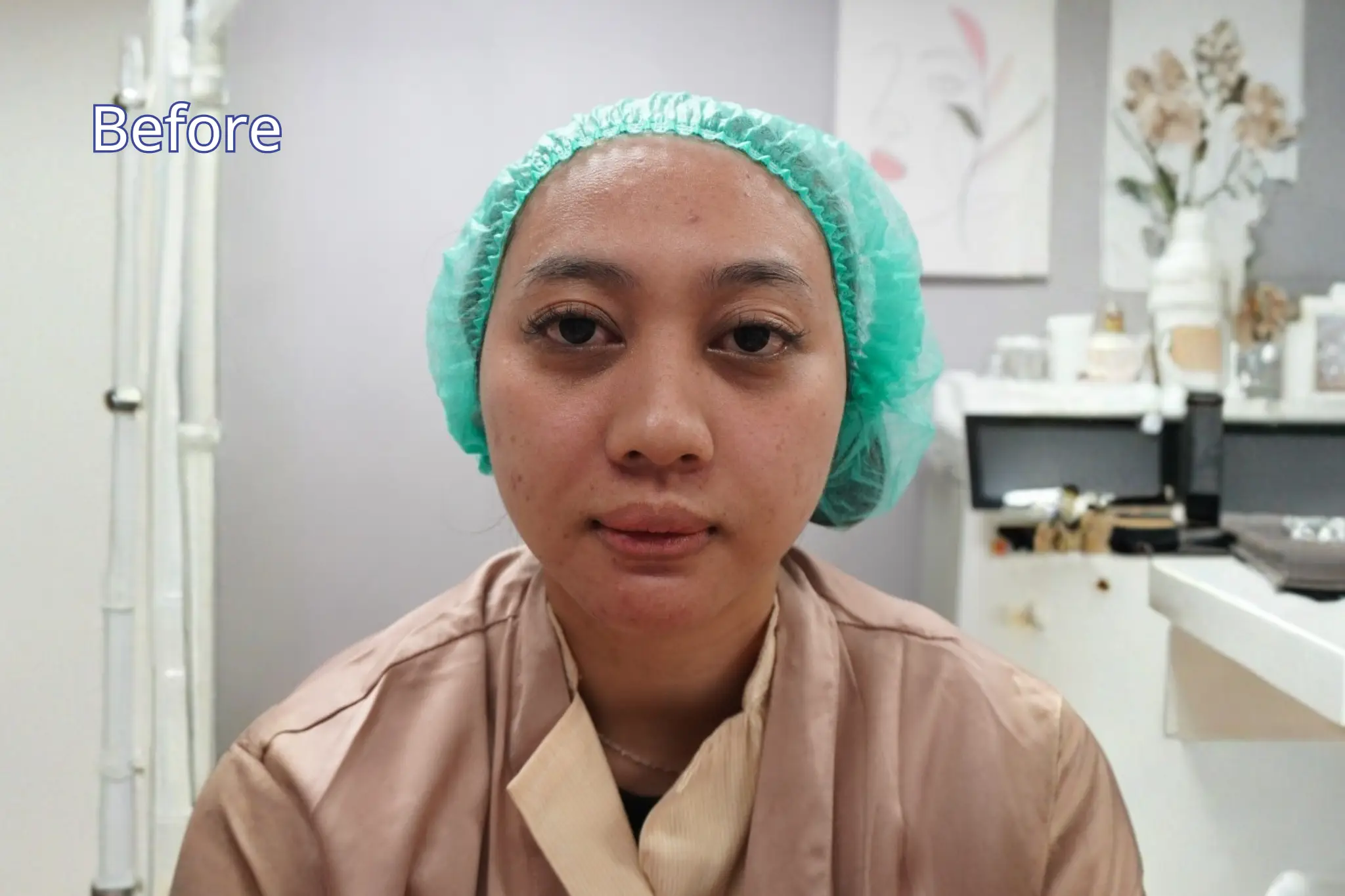 Skin booster pandawa 3