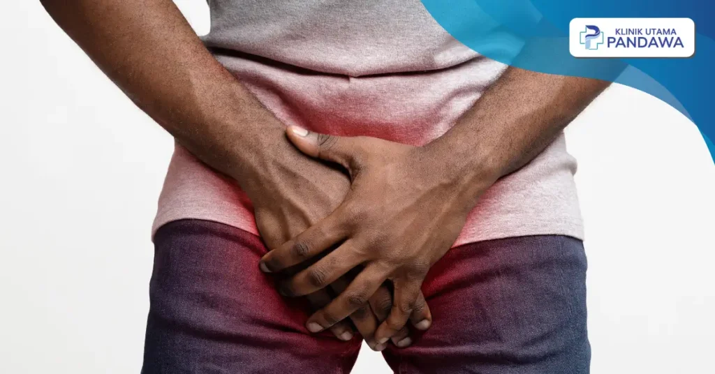 cara mengobati varises pada testis