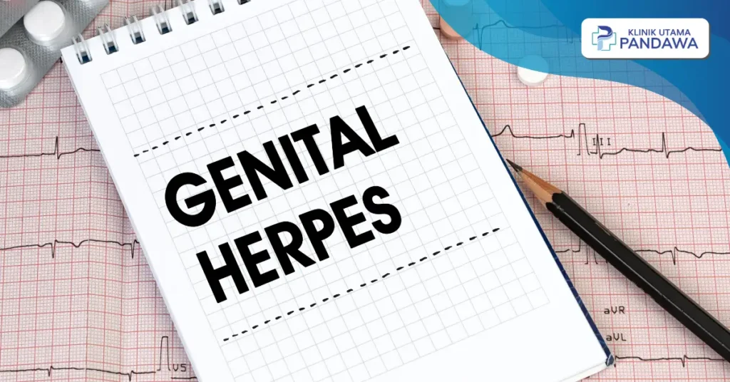 pengobatan herpes genital