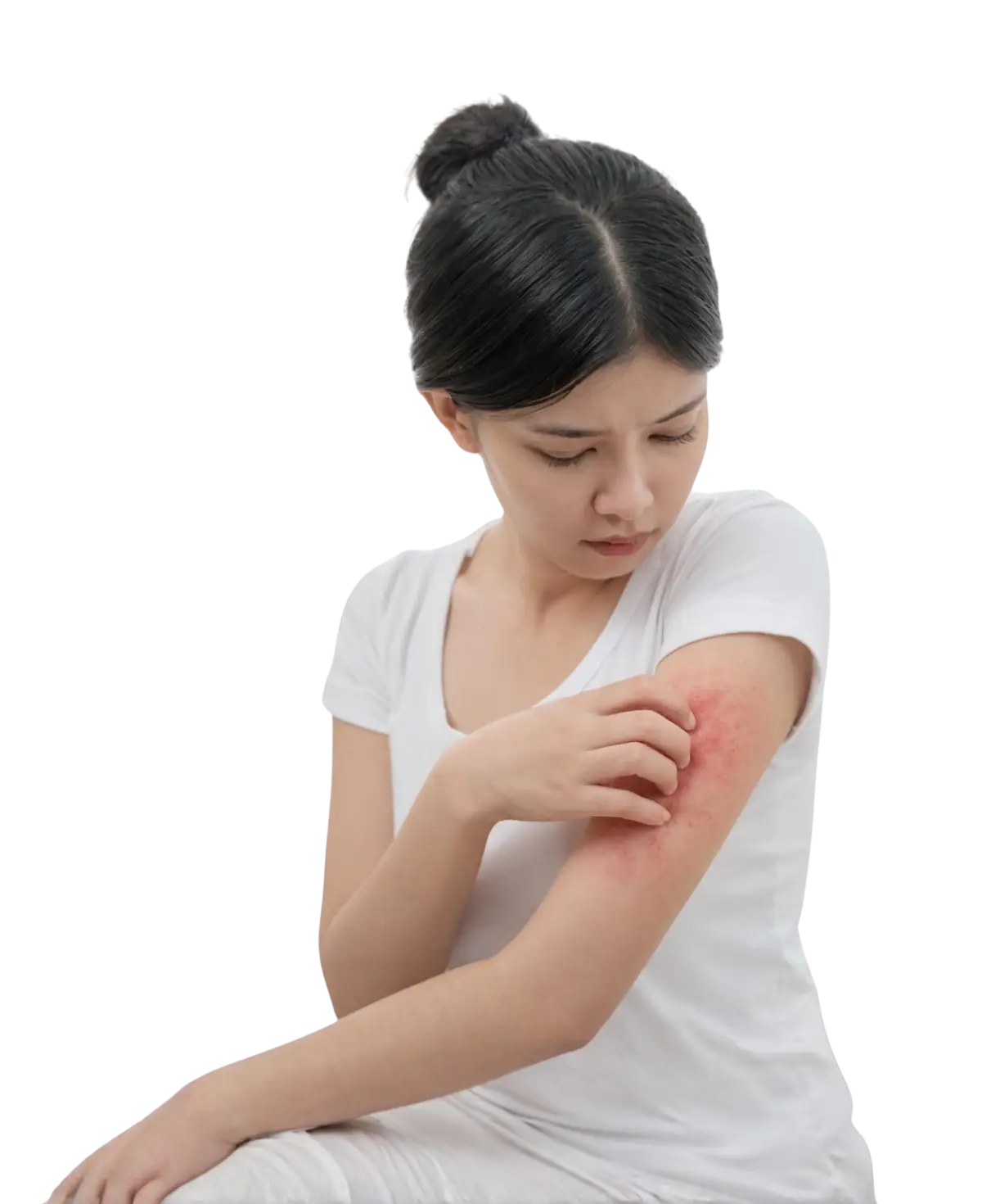 Penyakit kulit - KUP