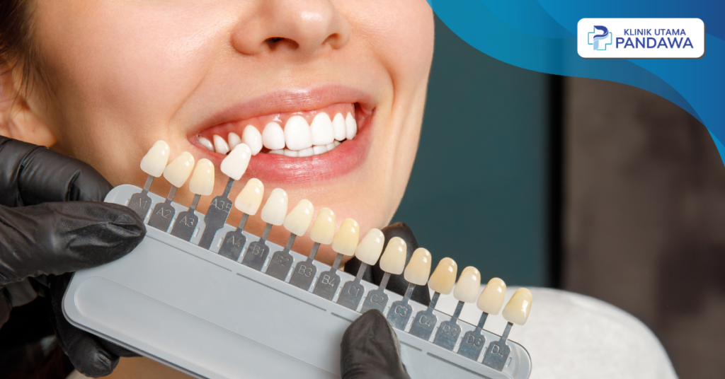 harga pasang gigi kelinci